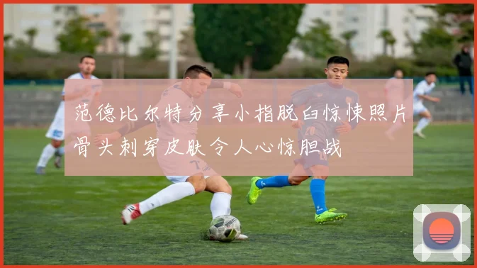 范德比尔特分享小指脱臼惊悚照片骨头刺穿皮肤令人心惊胆战